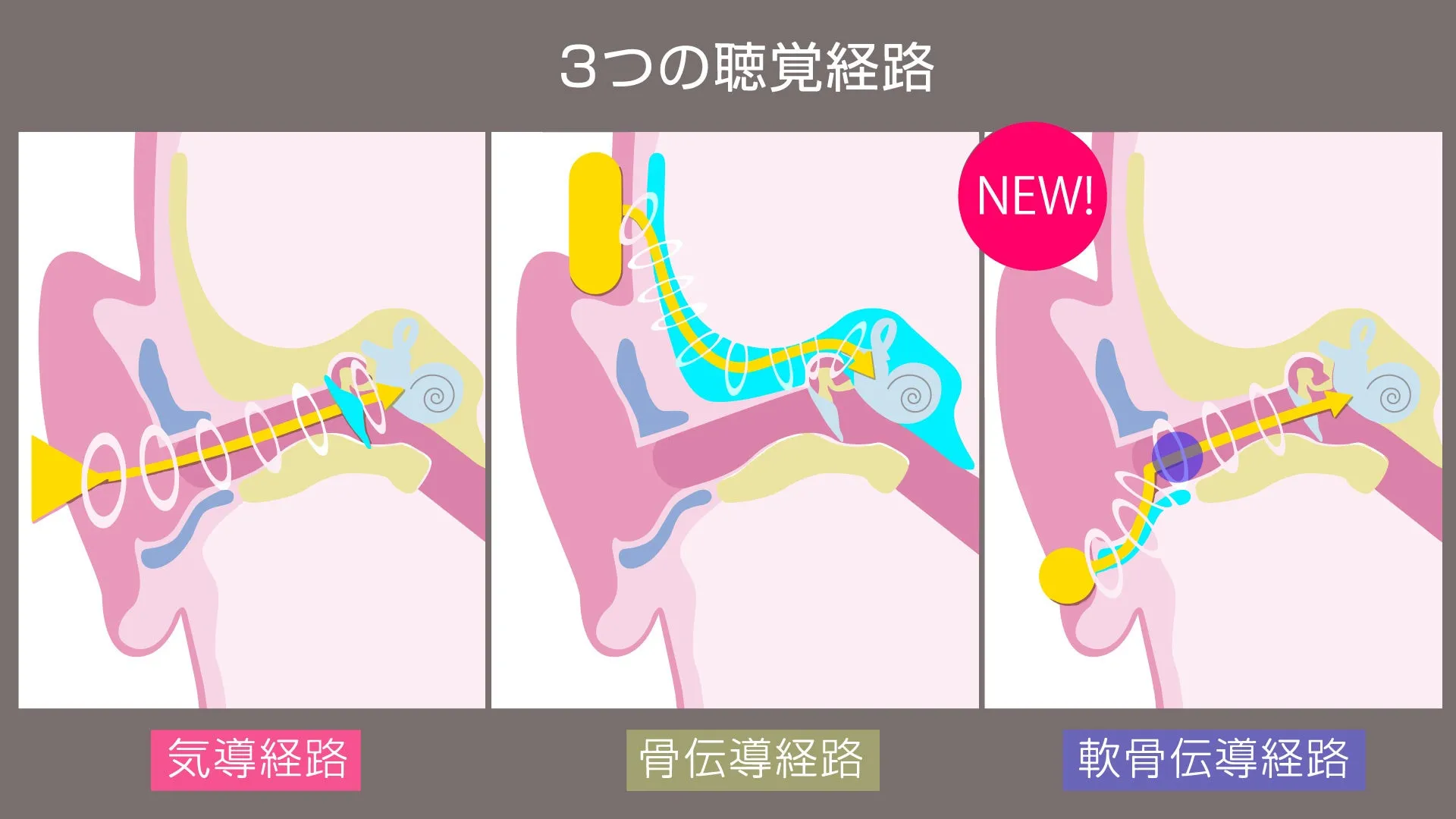 耳の3つの聴覚経路を示すイラスト