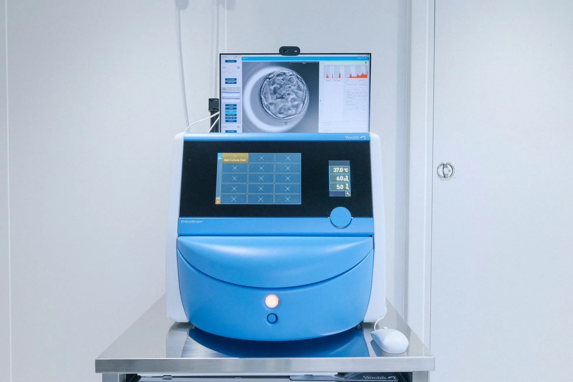 胚培養器EmbryoScope+の写真。モニターには胚の画像が表示され、温度などのパラメータも表示されている。
